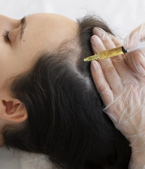 Plasma rico en plaquetas como bioestimulador
                                        natural.